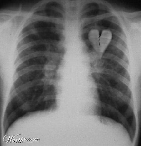 coeur bris&eacute; !